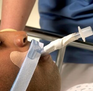 Endotracheal Tube Holder Stabilock?