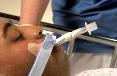 Endotracheal Tube Holder Stabilock?