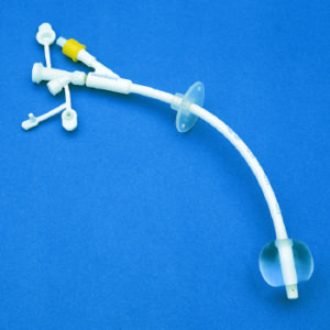 Gastrostomy Feeding Tube with Y Ports Kangaroo™ 20 Fr. Silicone Sterile